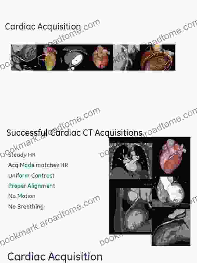 Optimized Cardiac CT Acquisition Technique Cardiac CT Marc Dewey