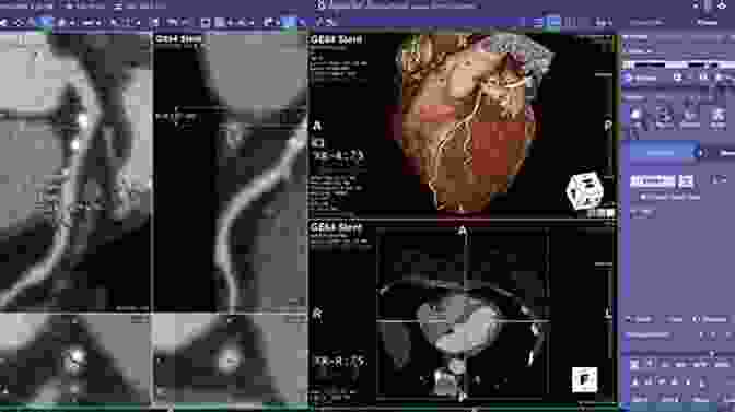 Pioneering Techniques In Cardiac CT Cardiac CT Marc Dewey