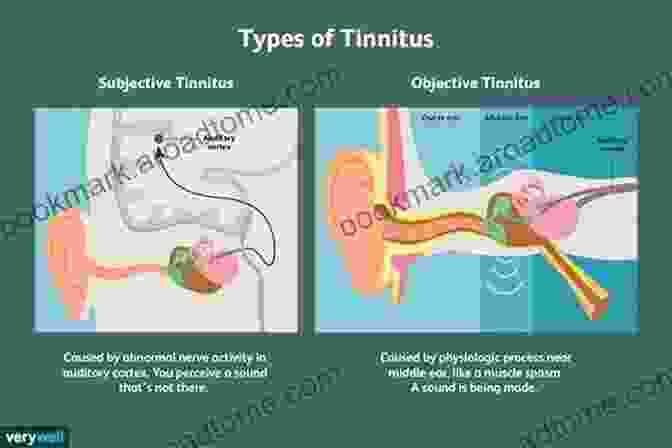 Tinnitus In The Ear I Can Live With My Tinnitus: A Survival Guide For Tinnitus Sufferers