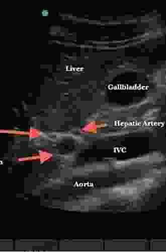 Operative Ultrasound Of The Liver And Biliary Ducts