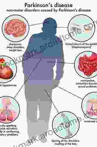 Psychiatric Issues In Parkinson S Disease: A Practical Guide