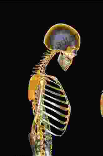 Skeletal Aging And Osteoporosis: Biomechanics And Mechanobiology (Studies In Mechanobiology Tissue Engineering And Biomaterials 5)